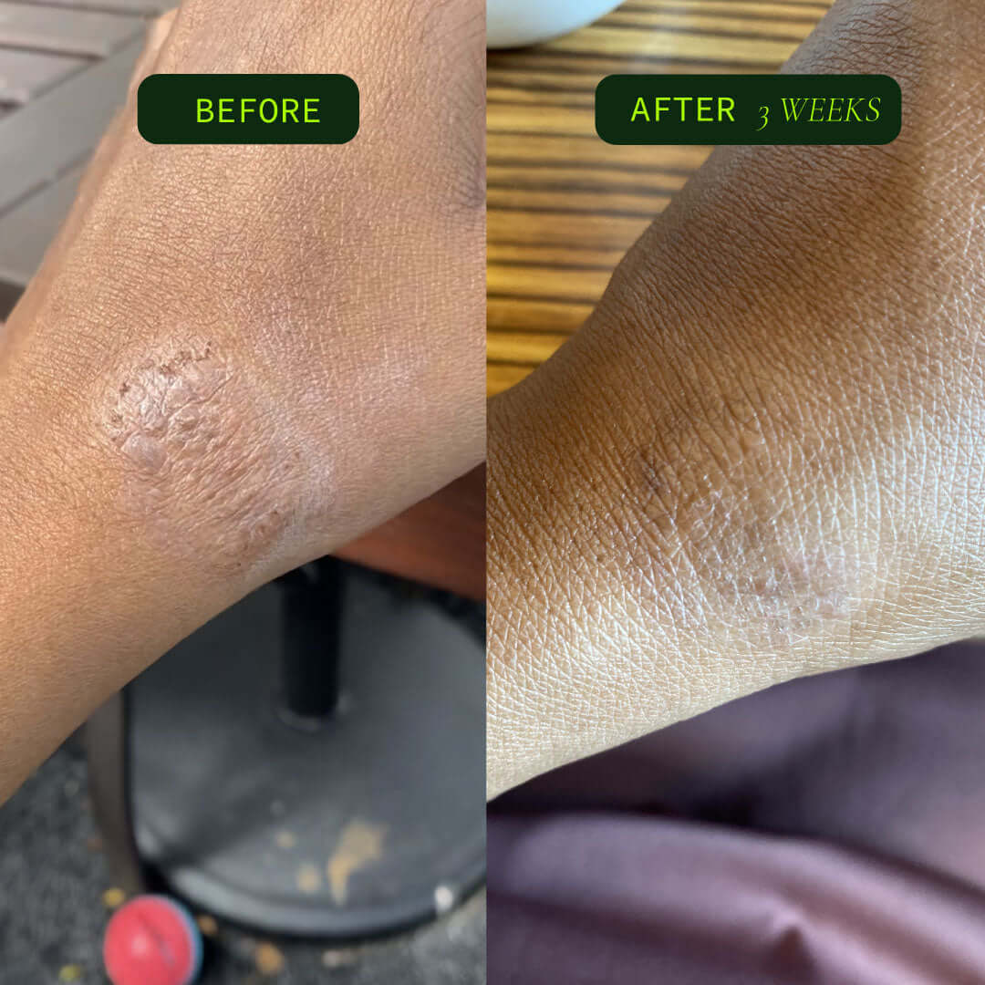Omega Body Oil